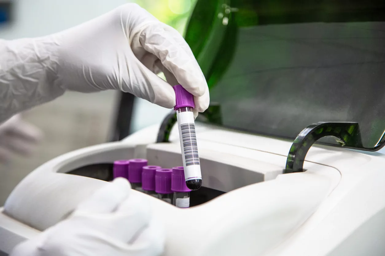 blood samples being arranged for processing